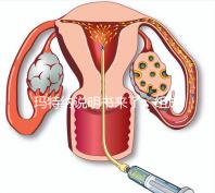 瑪特納說明書來了,組成成分、生產(chǎn)國家這都有