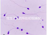 獨(dú)生子女的壞處初現(xiàn)端倪，贍養(yǎng)父母已成難題