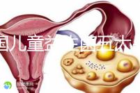 美國兒童益生菌五大品牌排行榜,康萃樂、家得路榜上有名