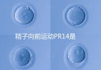 精子向前運動PR14是否正常聽專家怎么說,當心弱精找上門