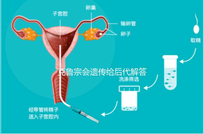 克魯宗會(huì)遺傳給后代解答嗎？他生來(lái)就有一篇清晰的文章嗎？