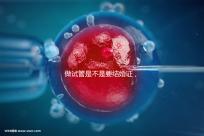 做試管是不是要結(jié)婚證,做試管需要結(jié)婚證