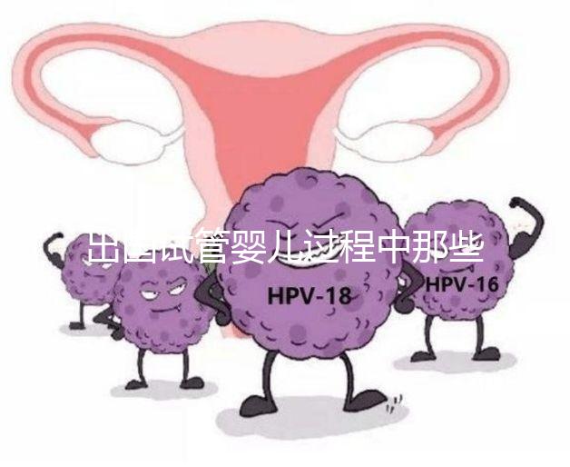 出國試管嬰兒過程中那些困惑，12個常見問題釋疑