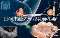 別問未婚先孕彩禮會不會少了，一分不給也不無可能