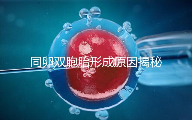 同卵雙胞胎形成原因揭秘，發育過程圖帶你弄清其中原理