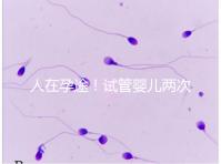 人在孕途！試管嬰兒兩次胎停育,了解這幾招能降低流產(chǎn)風險