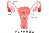 產后喝生化湯排惡露會使寶寶拉肚子？醫生：時間沒用對
