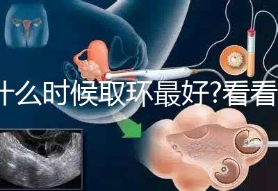什么時候取環(huán)最好?看看各地姐妹們有什么經(jīng)驗之談