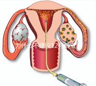 為什么不建議12月齡寶寶打水痘疫苗,醫生道出其中端倪