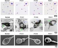 為什么要打醋酸加尼瑞克?試管拮抗劑方案的“穩(wěn)定劑”