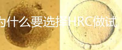為什么要選擇HRC做試管？這6大優勢看完就知道答案