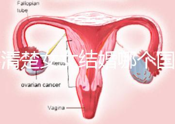 不清楚女女結(jié)婚哪個(gè)國(guó)家能領(lǐng)證來(lái)看,歐洲這些地區(qū)都可