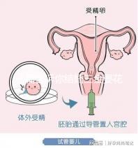 一篇告訴你結婚三金要花多少錢,高不高還得看克數(shù)