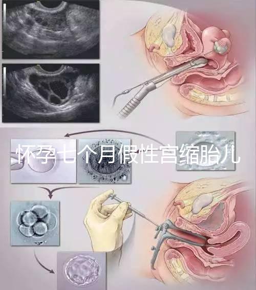 懷孕七個月假性宮縮胎兒可能缺氧，處理不好對胎兒影響大