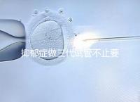 抑郁癥做三代試管不止要基因檢測，這兩大條件也得滿足