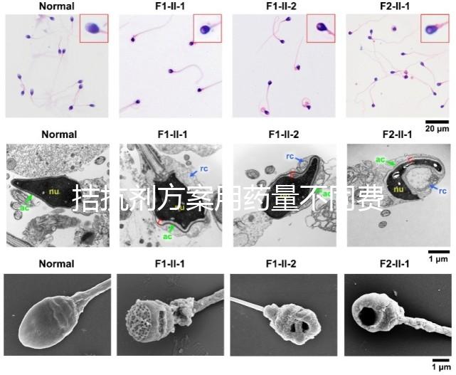 拮抗劑方案用藥量不同費(fèi)用也不一樣，看看大家都花了多少