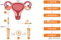 無性婚姻做試管嬰兒后來怎么樣？三個大案例揭開了內幕