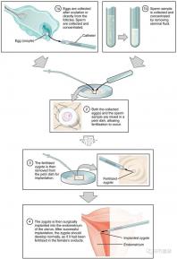 武漢四維彩超費用表整理，內(nèi)附市婦保院超全預約攻略