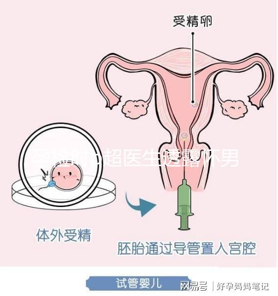 孕檢時b超醫(yī)生透露懷男寶女寶暗語寶典,一語戳中有心人!