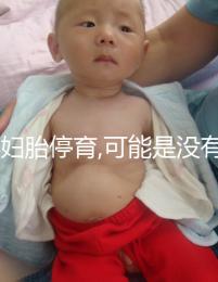 孕婦胎停育,可能是沒有做好沒做好檢查,這3個(gè)辦法值得嘗試