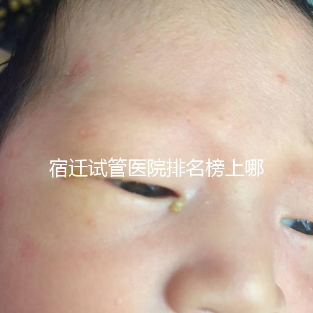 宿遷試管醫(yī)院排名榜上哪家好，不造助孕成功率和費用別亂選