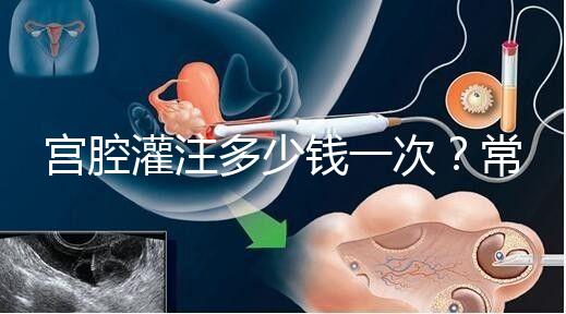 宮腔灌注多少錢一次?常見(jiàn)疑問(wèn)匯總答疑