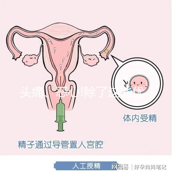 頭痛、惡心!除了這些優(yōu)思明副作用還有哪些