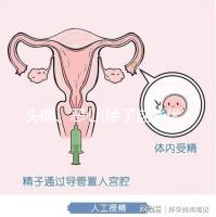 頭痛、惡心!除了這些優(yōu)思明副作用還有哪些