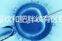 妊娠紋和肥胖紋有區(qū)別,教你3種“花紋”診斷鑒別的方法