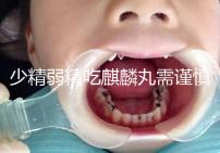 少精弱精吃麒麟丸需謹(jǐn)慎!千萬別忽視這4大副作用