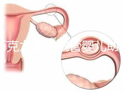 巧克力囊腫試管嬰兒助孕應(yīng)先治療?網(wǎng)友看法均有差異