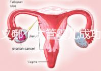 遵義哪個試管嬰兒成功率高?貴州生殖中心醫(yī)院2024年排名參考