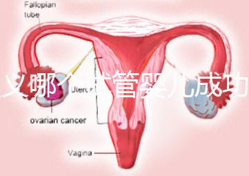 遵義哪個試管嬰兒成功率高？貴州生殖中心醫院2024年排名參考