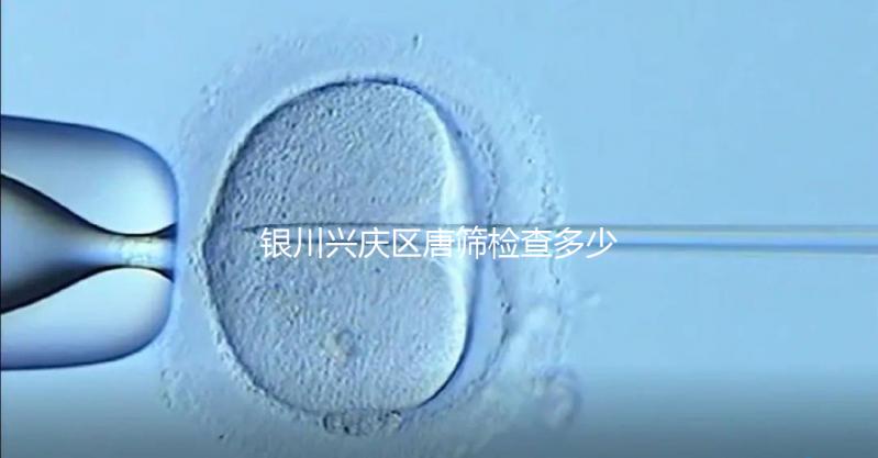 銀川興慶區(qū)唐篩檢查多少錢取決于情況,2024年國(guó)家免費(fèi)限額