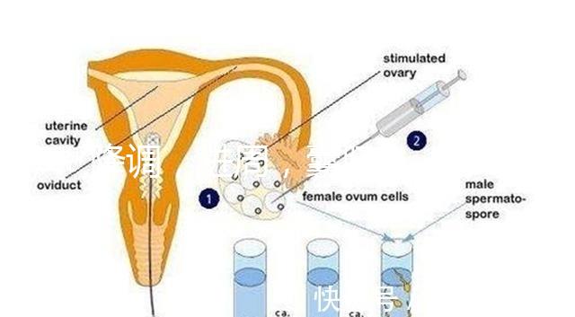 降調，進周，囊胚……這些試管嬰兒助孕術語你都懂嗎？