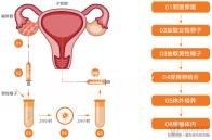 荷蘭萊頓同性結(jié)婚合法化20多年了！前提是滿(mǎn)足這三大條件