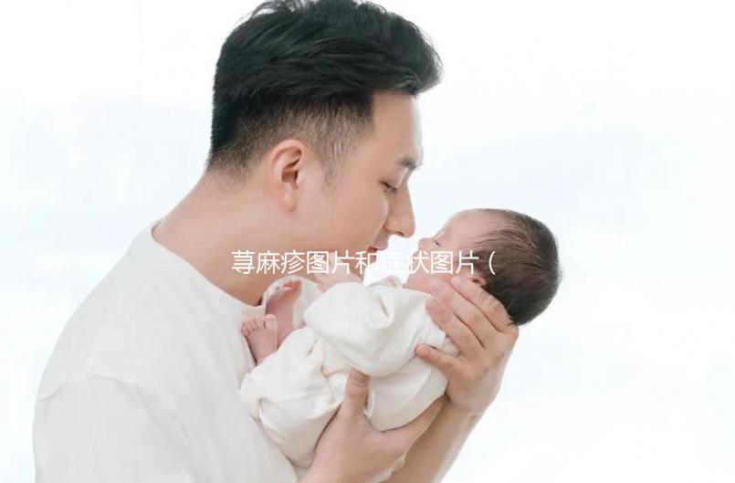 蕁麻疹圖片和癥狀圖片（蕁麻疹圖片和癥狀圖片怎么辦）