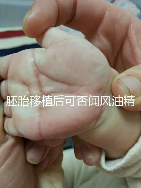 胚胎移植后可否聞風油精速覽，導致著床失敗真不是鬧著玩
