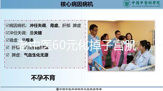 老中醫(yī)60元化掉子宮肌瘤偏方一覽,三棱效果怎樣用了就造