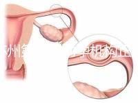 蘇州第三代助孕機構正規可靠嗎？實地考察才為真