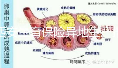 西安生育保險(xiǎn)異地生產(chǎn)報(bào)銷流程及程序公開,不懂收藏