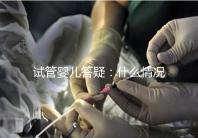 試管嬰兒答疑:什么情況下需要進行PGS和PGD?