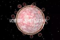 試管嬰兒移植懷孕14天，還能吃巧克力餅干嗎？