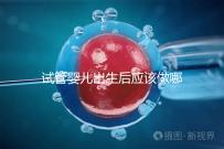 試管嬰兒出生后應(yīng)該做哪些檢查答案?DR應(yīng)該看情況嗎?