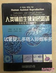 試管嬰兒多精入卵概率多少難說,比正常配對低別瞎操心