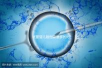 試管嬰兒建檔需要多長時(shí)間進(jìn)來瞧,內(nèi)含詳細(xì)流程供參考