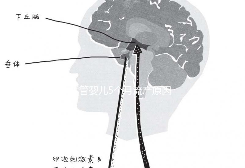 試管嬰兒5個月流產(chǎn)原因有三，多久能再次移植需慎重考慮