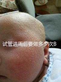 試管進周后要做多少次B超？需要檢查什么？進來看看