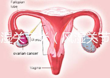 風濕關節(jié)炎(風濕關節(jié)炎的癥狀有哪些)