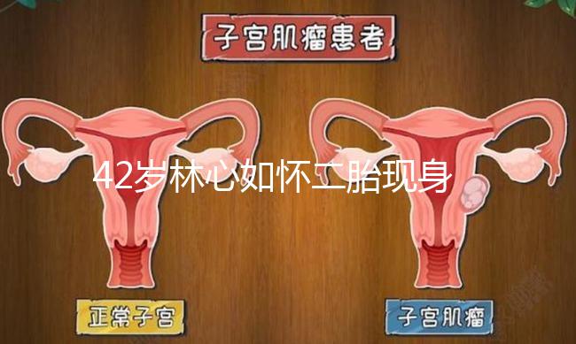 42歲林心如懷二胎現身新活動，霍建華全程陪同產檢回應